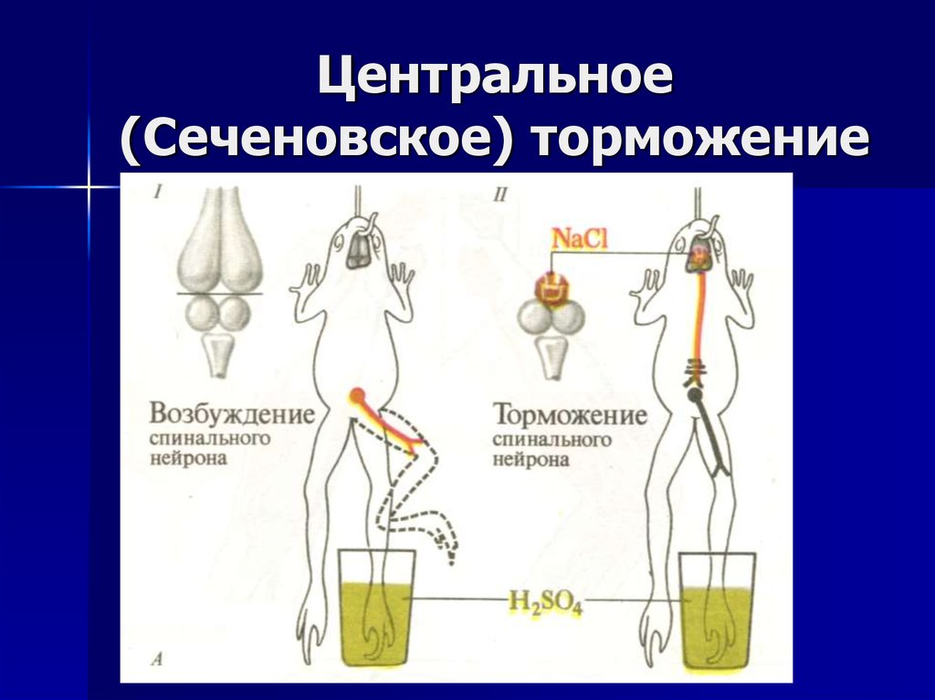 Схема центрального торможения