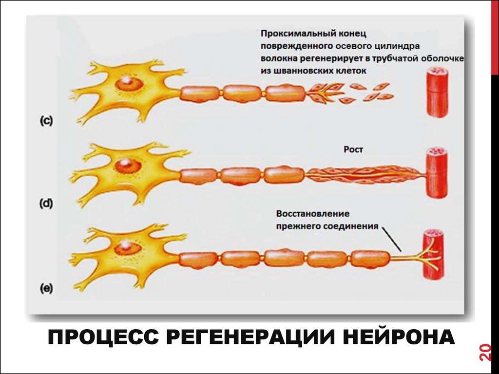 Дегенерация клеток. Регенерация миелиновых нервных волокон. Регенерация нервного волокна схема. Схема регенерации нейрона после повреждения его отростка. Регенерация нервной ткани гистология.