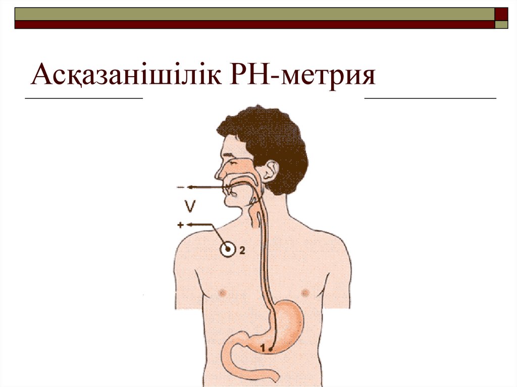 Рн метрия. Внутрипищеводная PH-метрия. Интраэзофагеальная РН-метрия. Внутрижелудочная РН-метрия. Внутрижелудочная РН-метрия схема.