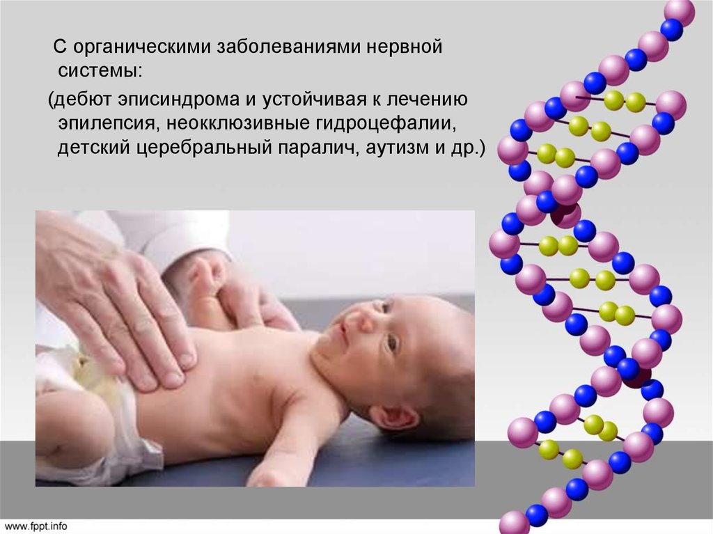 Биологические заболевания. Цитомегаловирусная инфекция у новорожденных презентация. Эписиндром лекарства. Эписиндром у взрослых симптомы. Органические заболевания нервной системы.