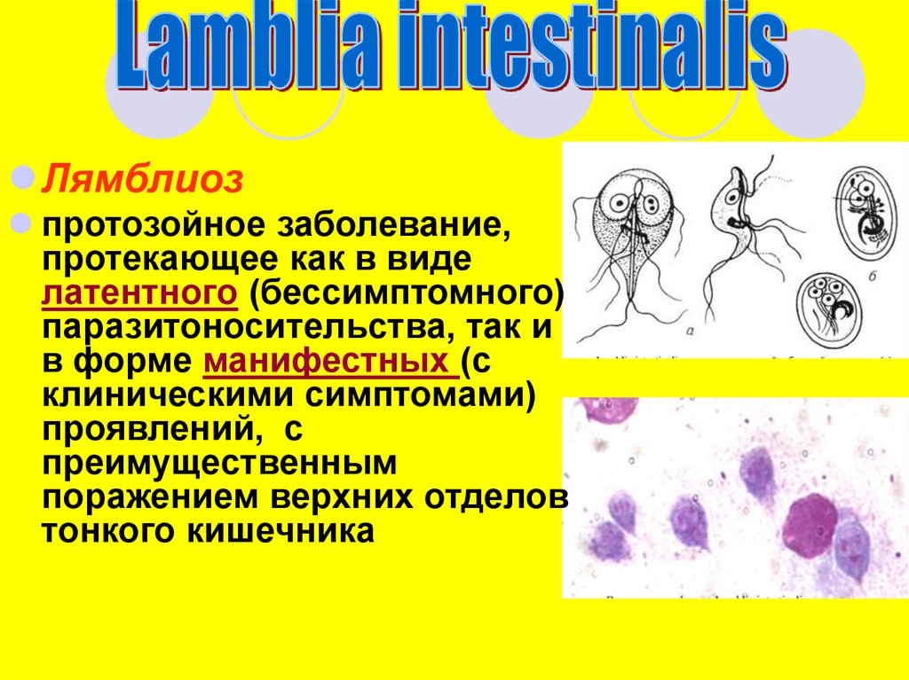 Протозойные инфекции лечение. Протозойные инфекции лямблиоз. Лямблия интестиналис заболевание. Лямблия клинические проявления. Lamblia intestinalis заболевание.