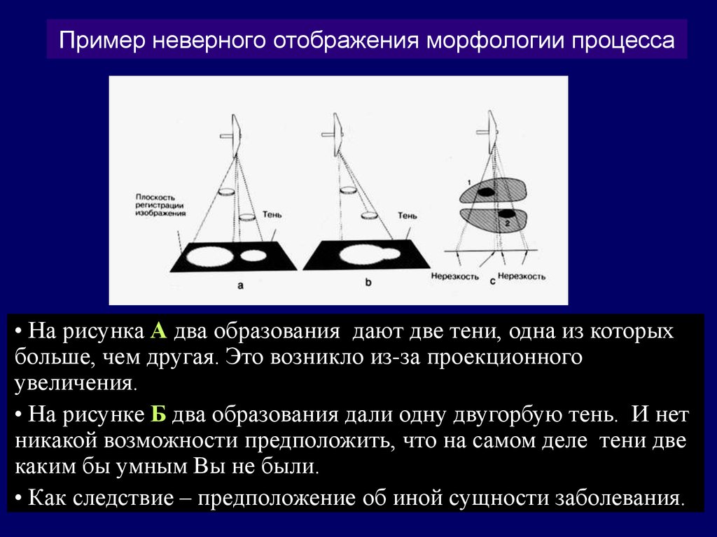 Нерезкость рентгеновского изображения