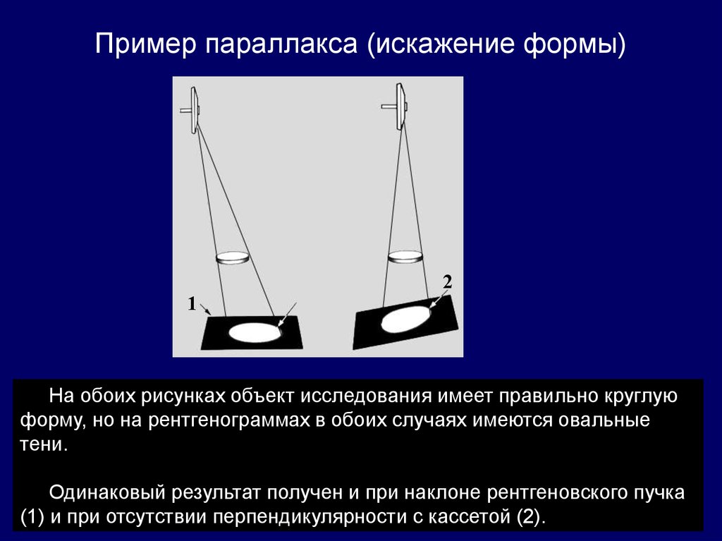 Чтобы размеры рентгеновского изображения были близки к истинным следует максимально