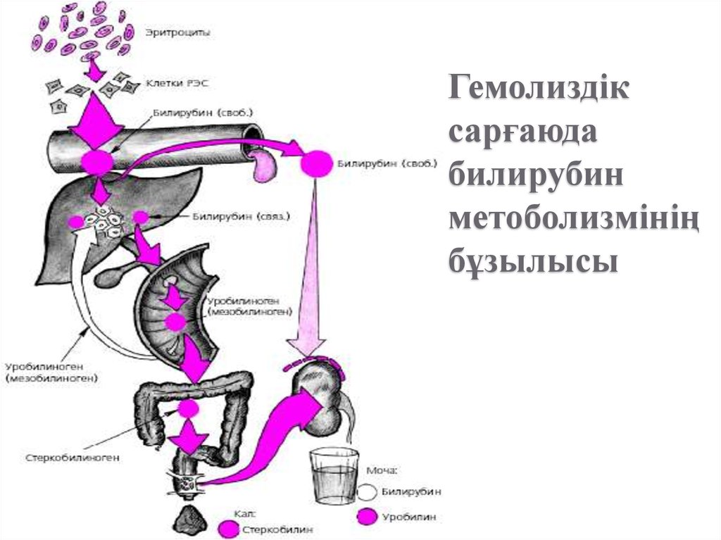 Патогенез механической желтухи схема