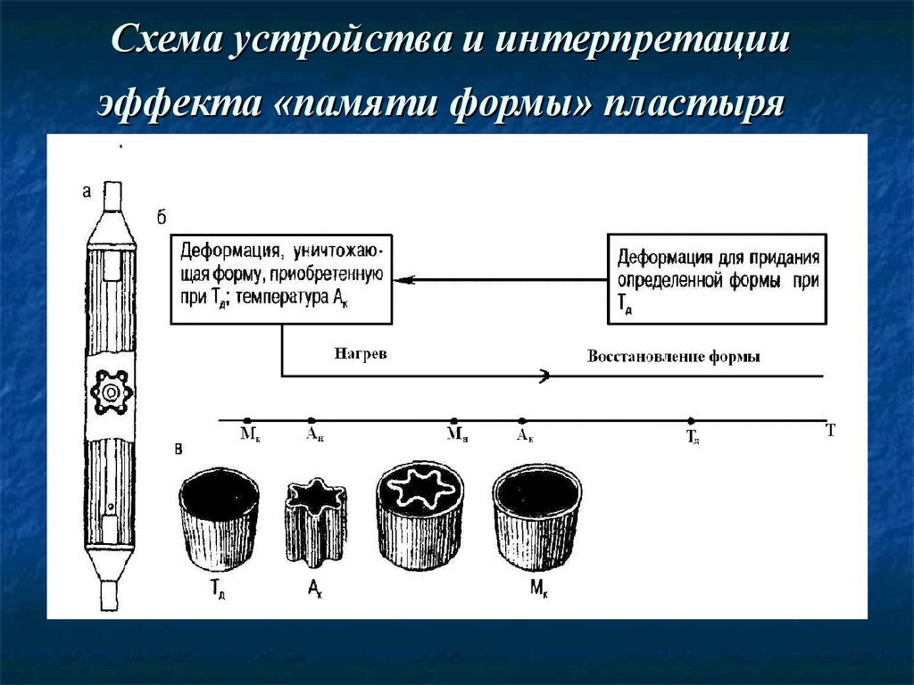 Схема устройства и интерпретации эффекта «памяти формы» пластыря