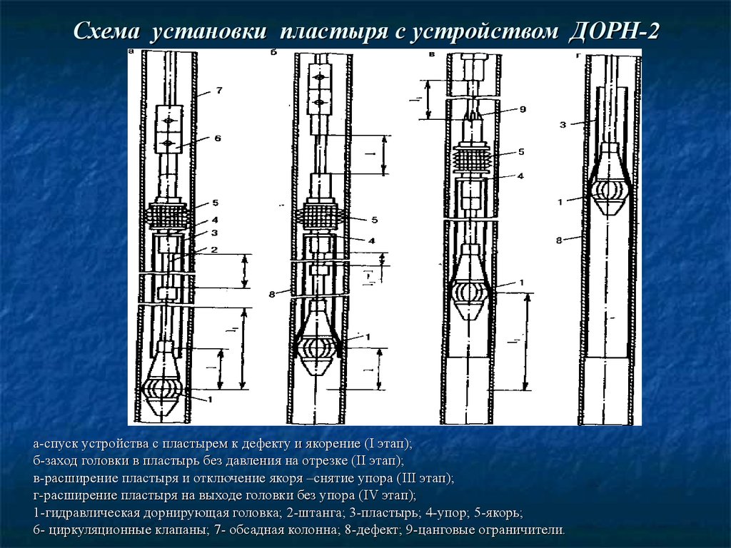 Схема установки пластыря с устройством ДОРН-2