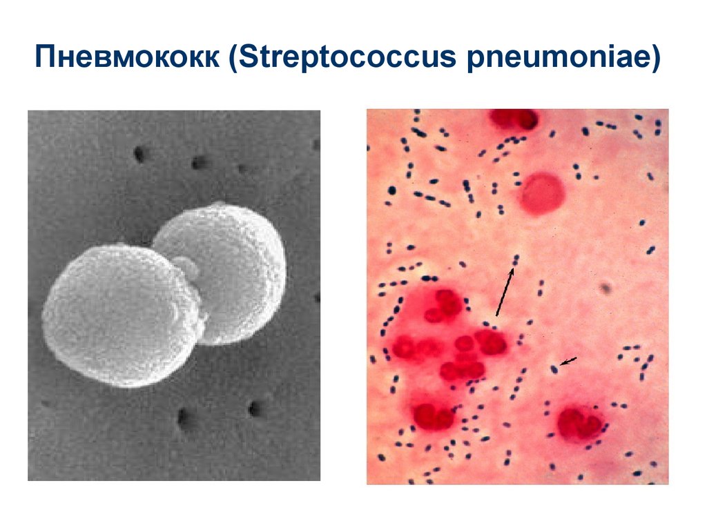 Пневмококк картинка бактерии