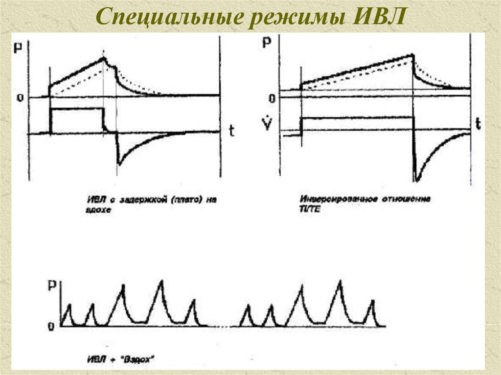 Ивл характеристики