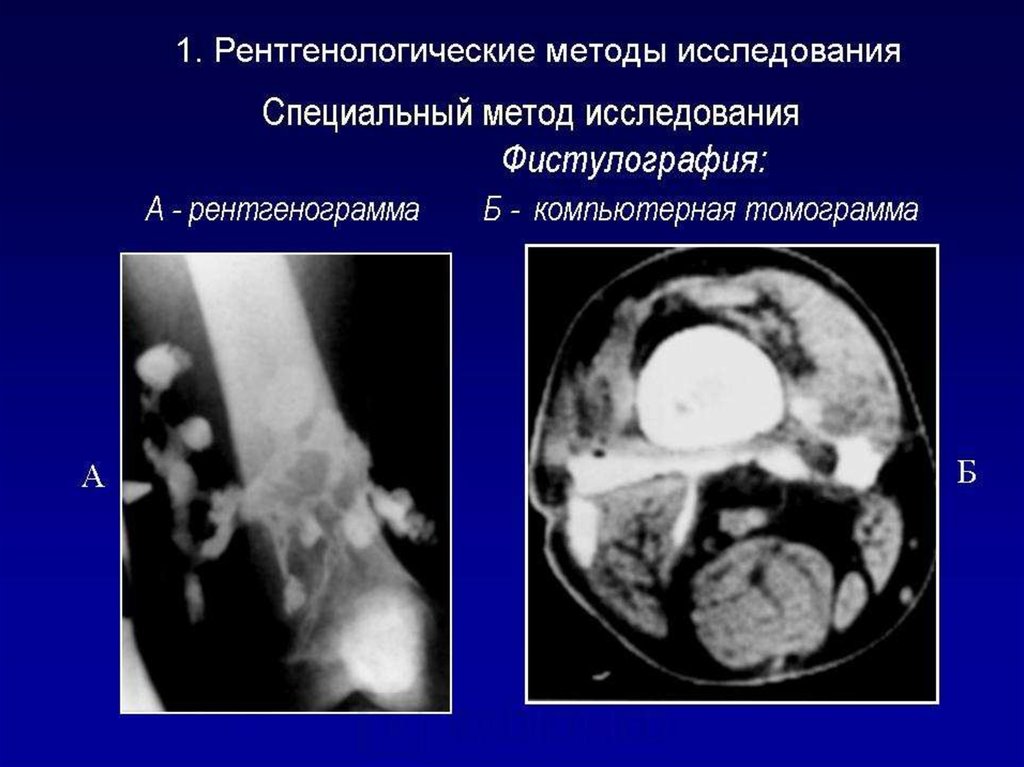 Виды способы методы методики лучевая анатомия семиотика