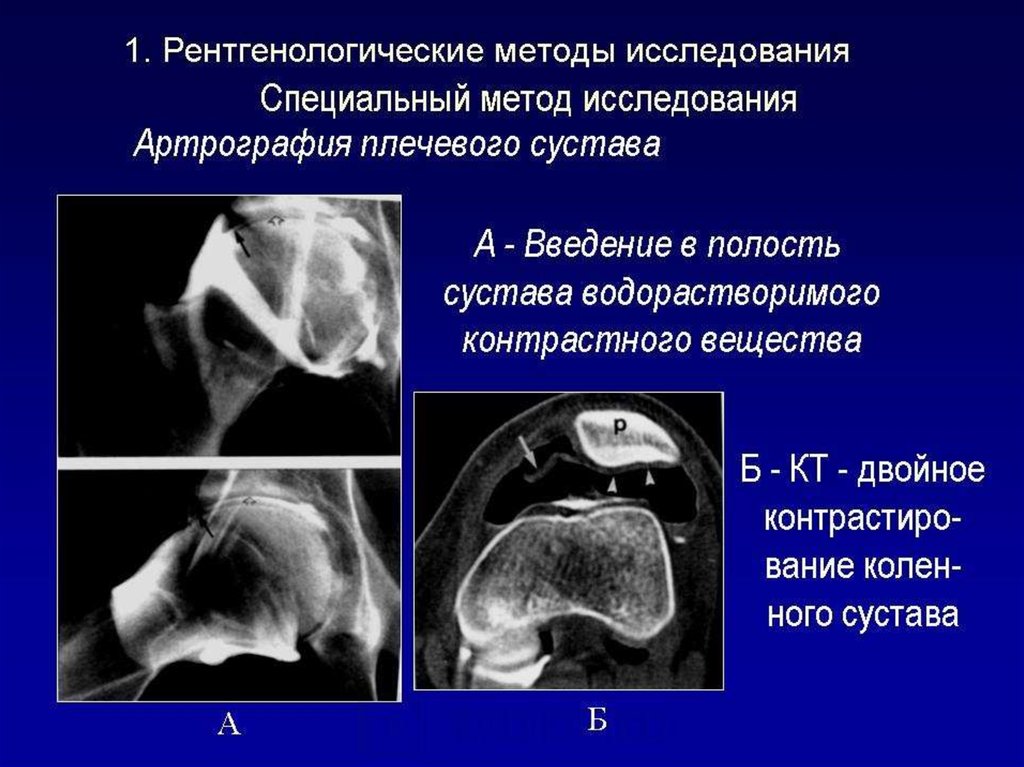 Лучевая диагностика костей презентация