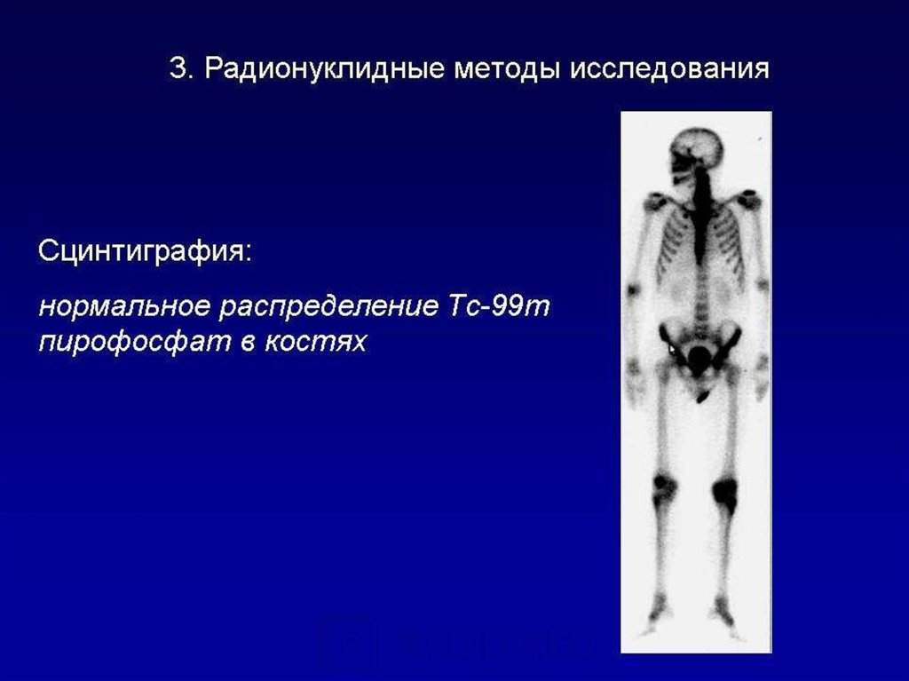 Методы исследования костно мышечной системы презентация