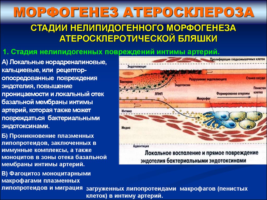 Стенозирующий атеросклероз. Осложнения атеросклероза коронарных артерий. Атеросклероз коронарных артерий стадии. Причины атеросклероза коронарных сосудов. Атеросклероз коронарных артерий (стадия 4, степень 3).