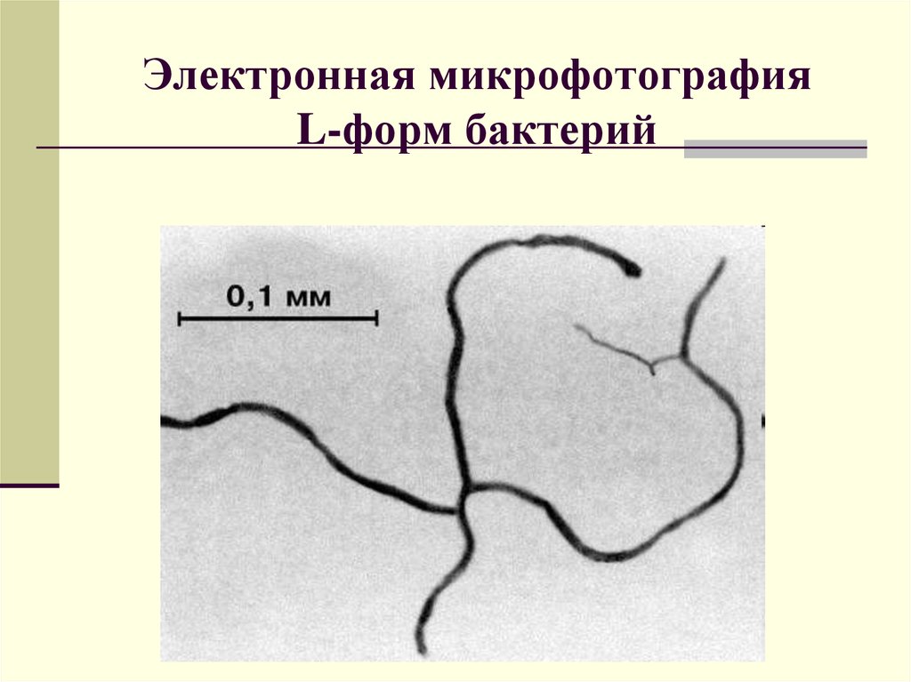 Форма л. Образование l форм бактерий микробиология. L формы бактерий. L-формы бактерий факторы образования. Л формы бактерий.