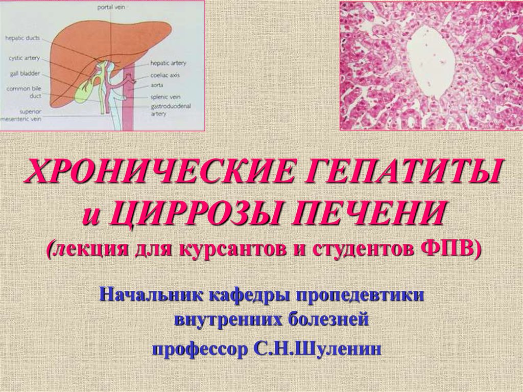 Хронический гепатит и цирроз печени презентация thumbnail