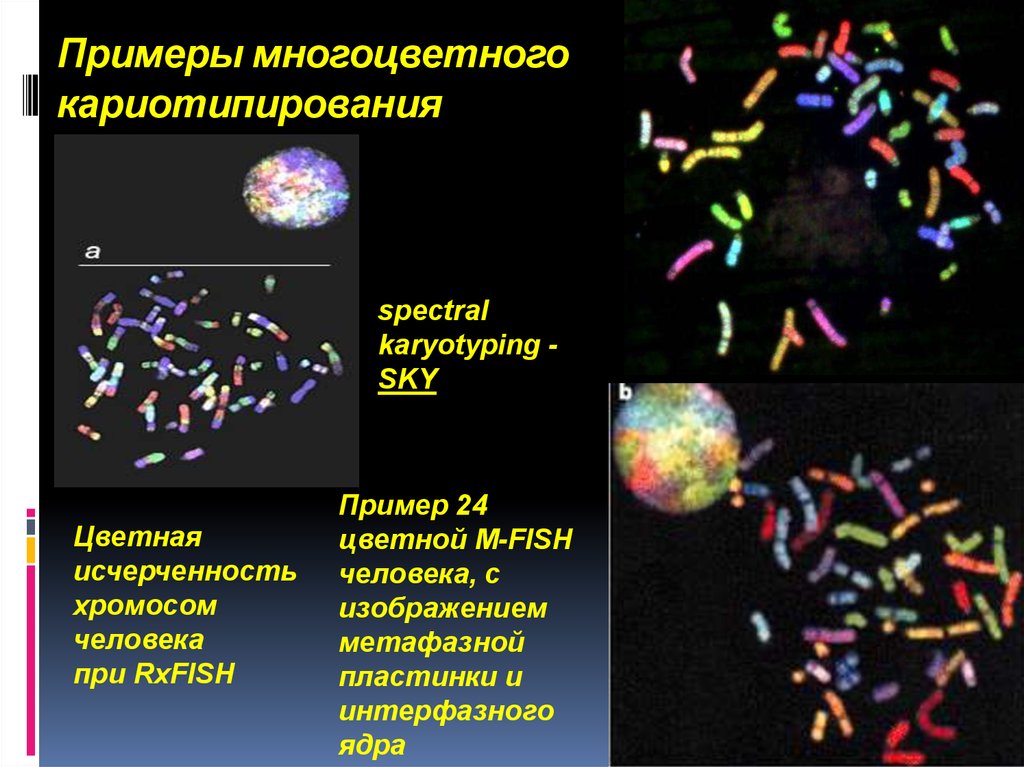 Метафазная пластинка. Методы кариотипирования хромосом человека. Спектральное кариотипирование. Метод спектрального кариотипирования. Кариотипирование молекулярно-генетический метод.