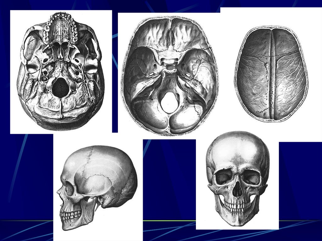Развитие черепа. Скелет черепа новорожденного. Скелет черепа череп новорожденного. Скелет головы младенца. Мутации черепа анатомия.