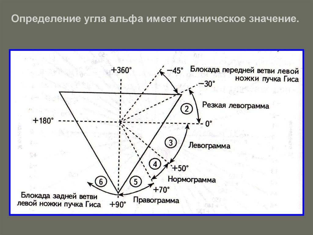 Диаграмма дьеда экг