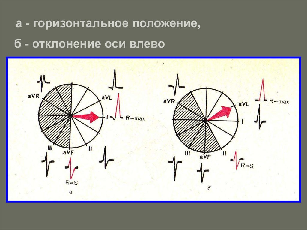 Горизонтальное расположение. Горизонтальное положение. Горизонтальное проложение. Горизонтальное положение оси. Проложение горизонтальное положение.