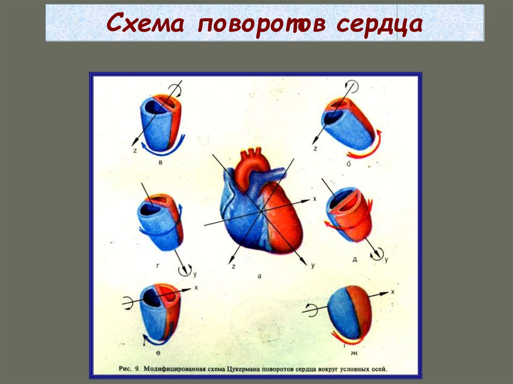 Поворот сердца правым желудочком вперед что это. Поворот сердца вокруг продольной оси. Повороты сердца вокруг оси на ЭКГ. Повороты сердца на ЭКГ вокруг продольной оси. Поворот сердца верхушкой кзади на ЭКГ.