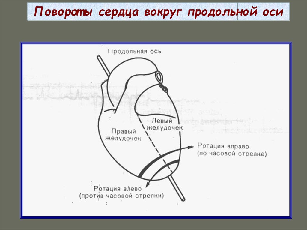 Поворот сердца правым желудочком вперед что это. Определение поворотов сердца вокруг продольной оси. Поворот сердца вокруг продольной оси против часовой стрелки на ЭКГ. Повороты сердца на ЭКГ вокруг продольной оси. Поворот сердца вокруг продольной оси по часовой стрелке.