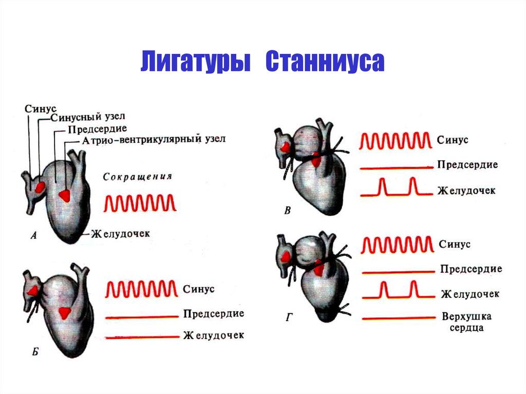 Сердце метода. Лигатуры Станниуса. Схема лигатур Станниуса. Лигатуры Станниуса физиология. Опыт с лигатурами Станниуса.