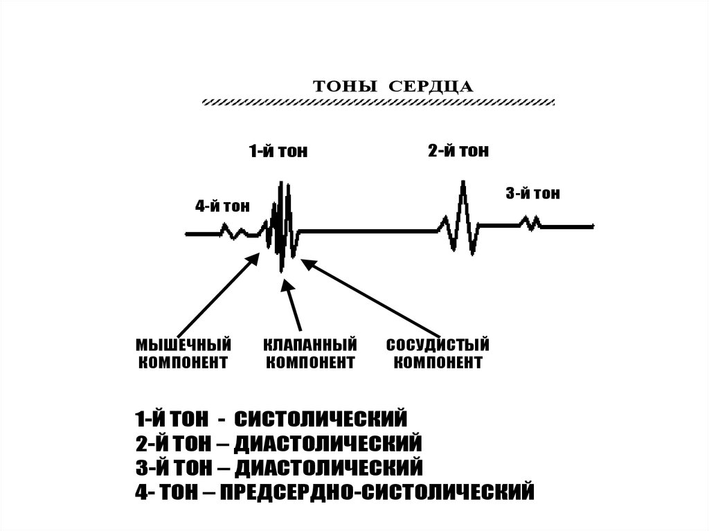 1 2 тона. Тоны сердца, механизмы их происхождения и методы исследования.. 4 Тоны сердца схема. Тоны сердца таблица механизм формирования. Тоны сердца и их происхождение физиология.