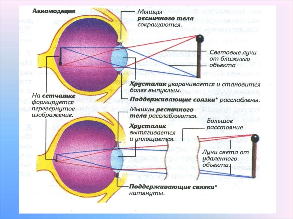 Расплывчатое изображение близкорасположенных предметов является признаком близорукости