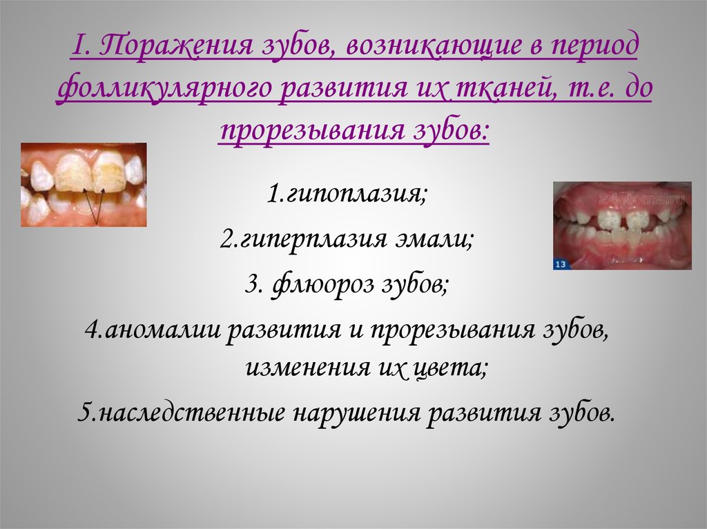 I. Поражения зубов, возникающие в период фолликулярного развития их тканей, т.е. до прорезывания зубов: