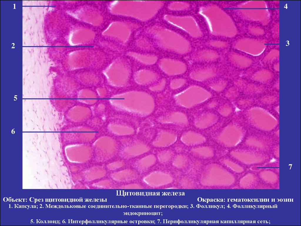 Щитовидная железа гистология. Щитовидная железа гистология препарат. Щитовидная железа микропрепарат гистология. Щитовидная железа собаки гистология препарат. Щитовидная железа препарат гематоксилин-эозин гистология.