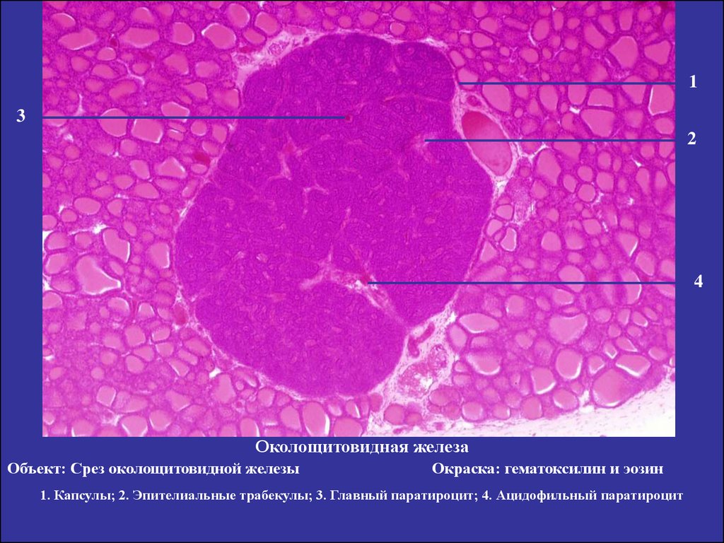 4 железа. Паращитовидная железа гематоксилин эозин. Паращитовидная железа гистология препарат. Щитовидная железа гистология препарат трабекулы. Паращитовидная железа гистология гематоксилин эозин.