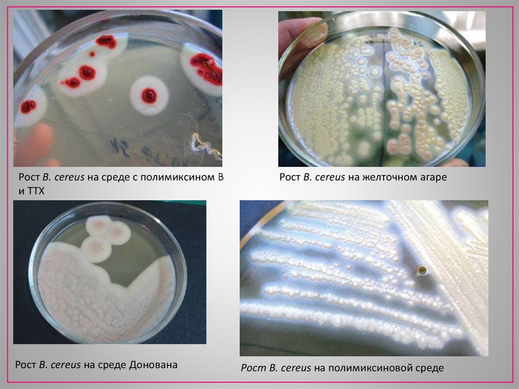 Курсовая работа по теме Роль Bacillus cereus в этиологии пищевых отравлений
