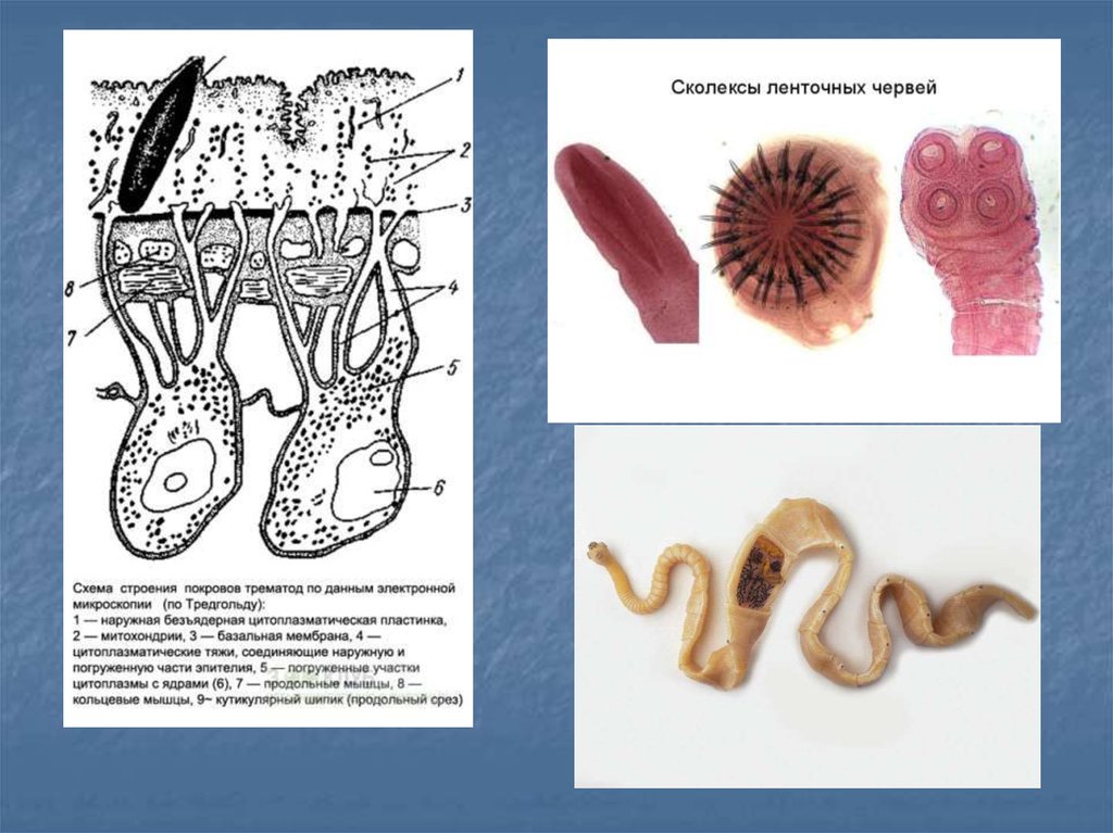 Ленточные и плоские черви. Медицинская гельминтология ленточные черви. Медицинская гельминтология Тип плоские черви. Плоские черви ленточные строение. Сколексы ленточных червей.