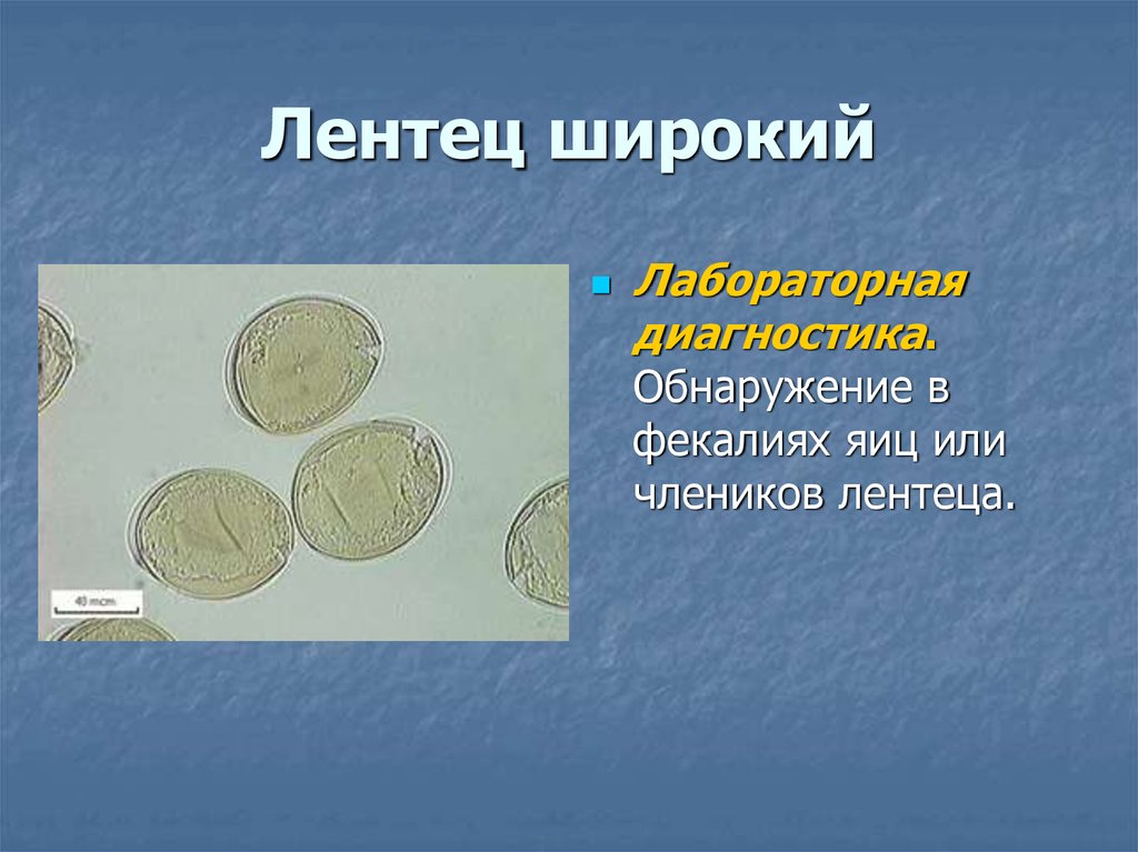 Широкий лентец это. Обнаружение яиц широкого лентеца. Методы лабораторной диагностики дифиллоботриоза. Дифиллоботриоз яйца.