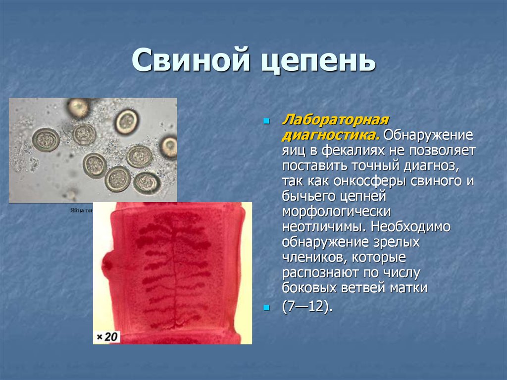 Яйца цепней. Строение яйца свиного цепня. Методы лабораторной диагностики бычий цепня. Строение онкосферы свиного цепня. Возбудитель свиного цепня.