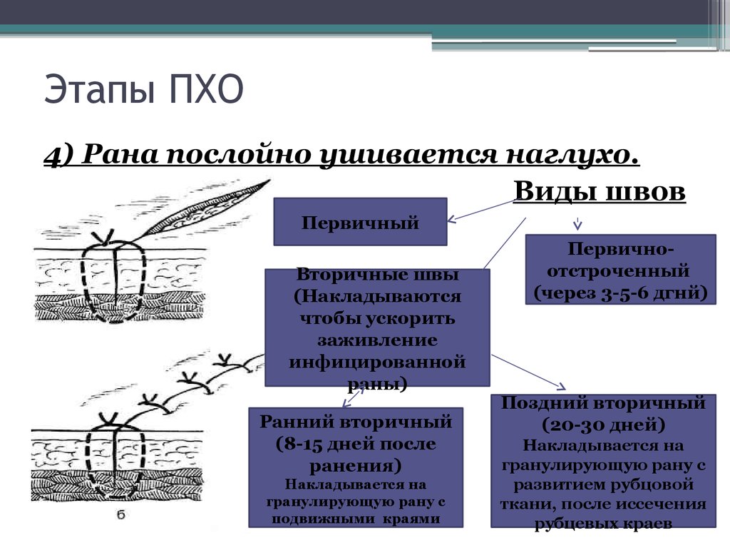 Особенности проведения пхо