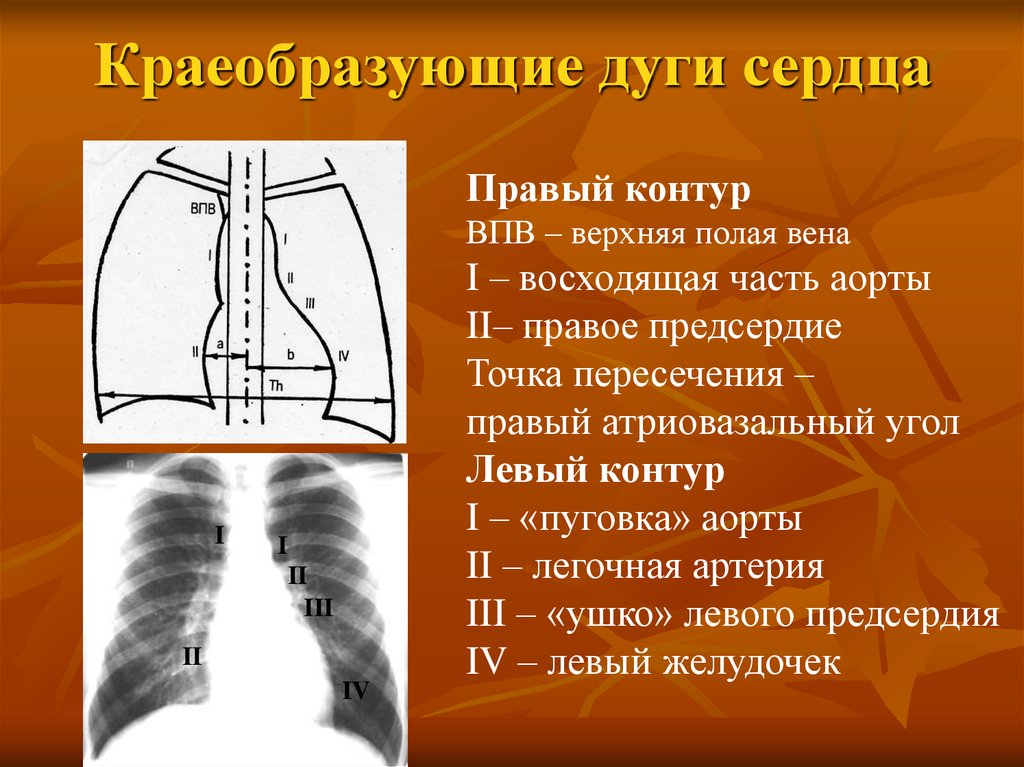Удлинена дуга. Контуры сердца рентген. Дуги сердца на рентгенограмме. Сердечные дуги на рентгенограмме. Дуги сердца на рентгене.
