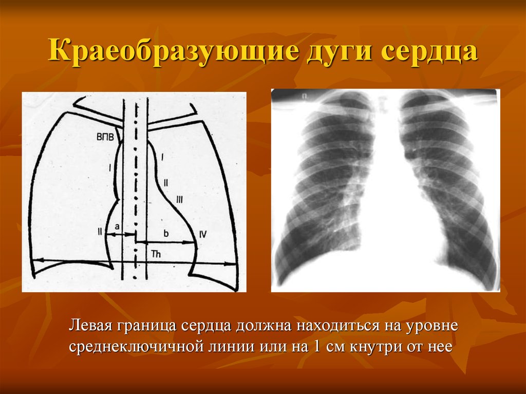 Левая граница. Рентген анатомия сердца дуги. Контуры сердца на рентгенограмме. Прямая проекция сердца. Дуги сердца на рентгене.