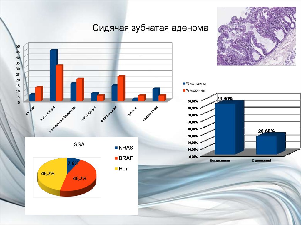 Сидячая зубчатая аденома