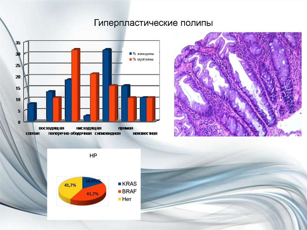 Гиперпластические полипы