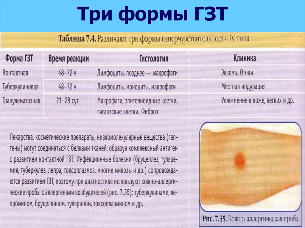 Гзт схема микробиология