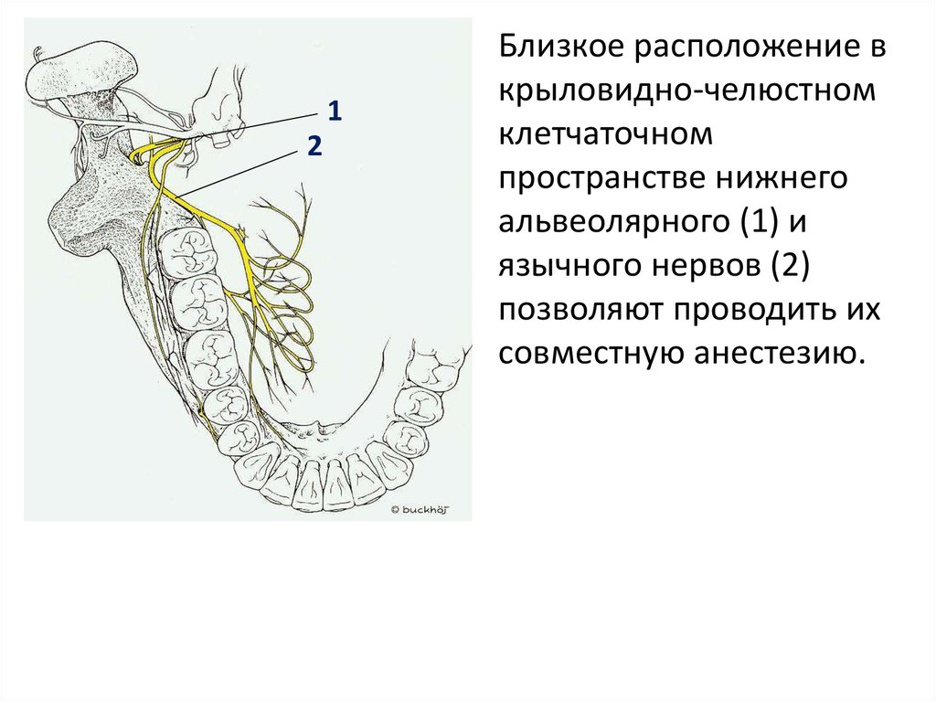 Щечная анестезия схема