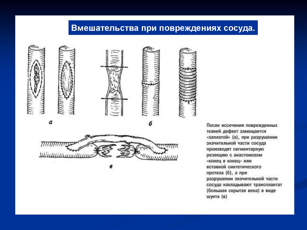 Какой сосуд поврежден на рисунке 1