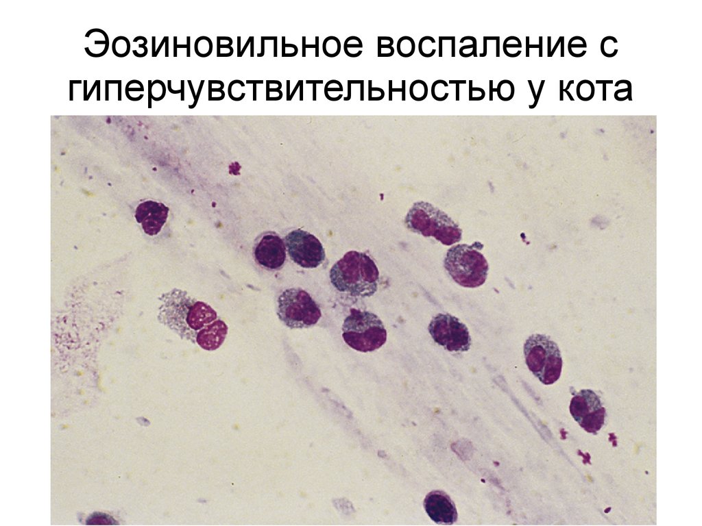 Бронхоальвеолярный рак презентация