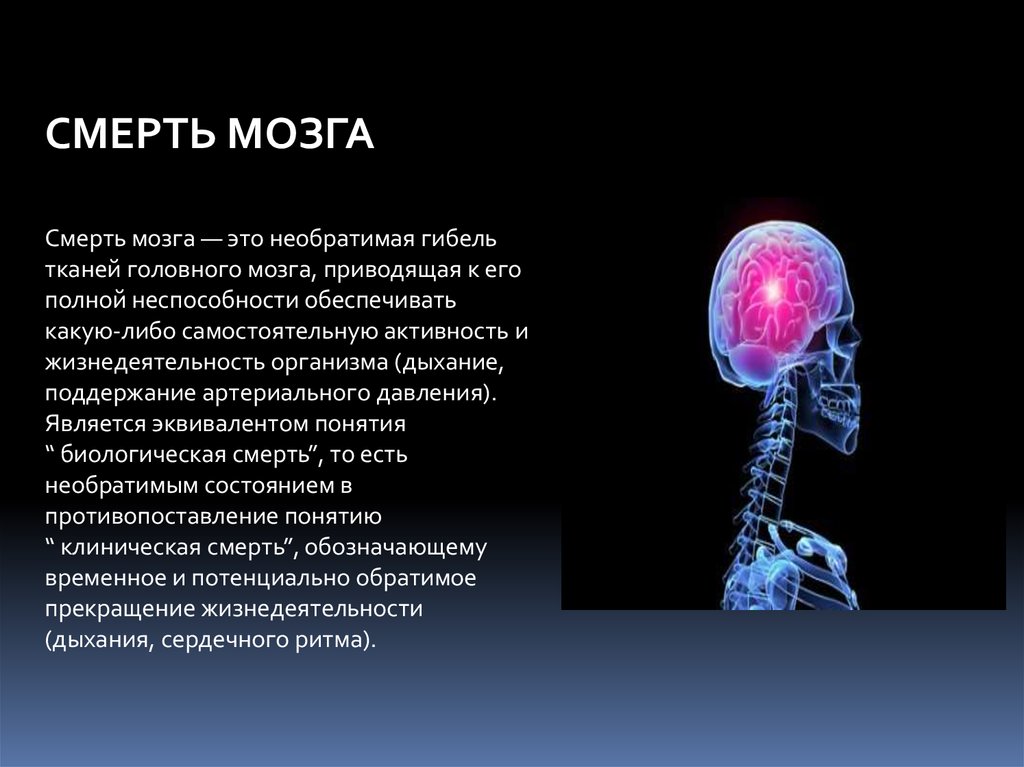 Смерть мозга презентация