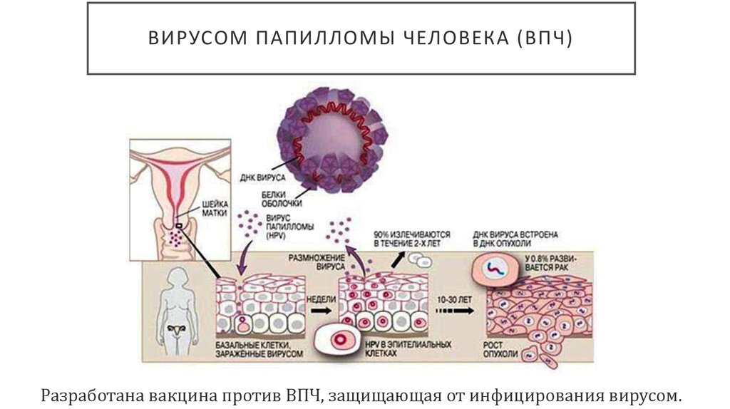 Впч в гинекологии лечение. Схема строения вируса папилломы человека. Папилломавирусная инфекция (ПВИ).