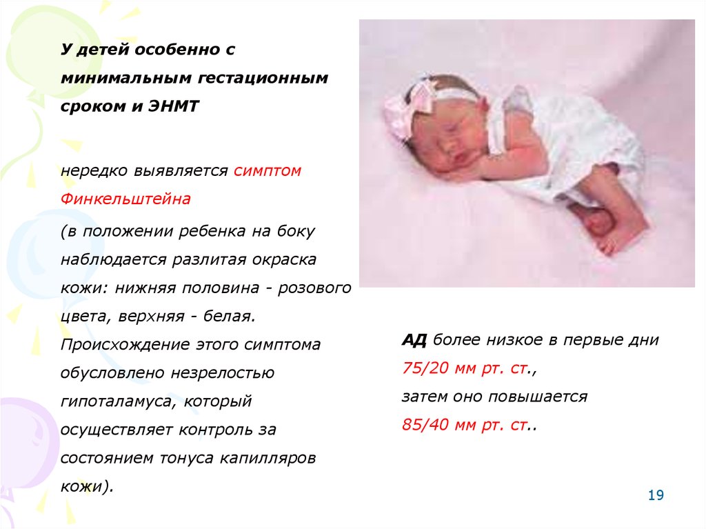 Гестационный возраст ребенка. Малый маловесный к сроку гестации. Симптом Финкельштейна Арлекино. Положение недоношенных детей. Вес ребёнка в 32 недели беременности.