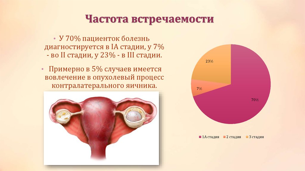 Частота встречаемости