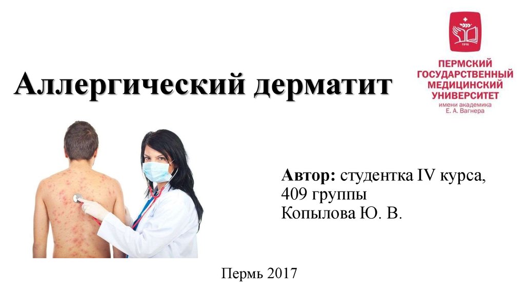 Крапивница мкб. Аллергический дематитмкб. Аллергический дерматит мкб. Аллергический дерматит мкб 10 у взрослых.