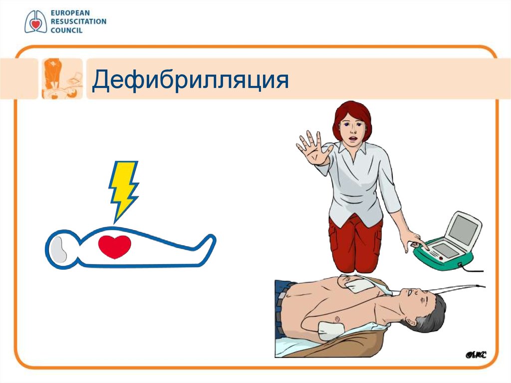 Алгоритмы помощи при остановке сердца