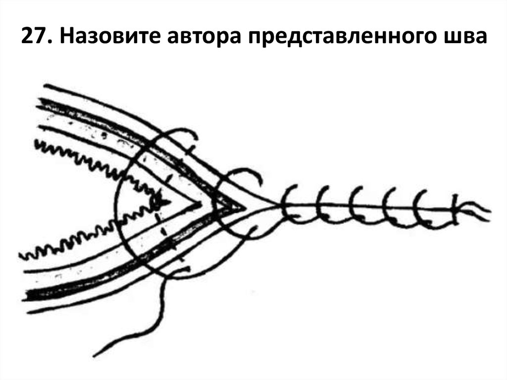 Какой шов изображен на рисунке